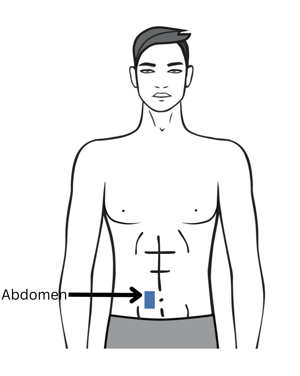 Illustration of the abdominal skinfold site next to the navel