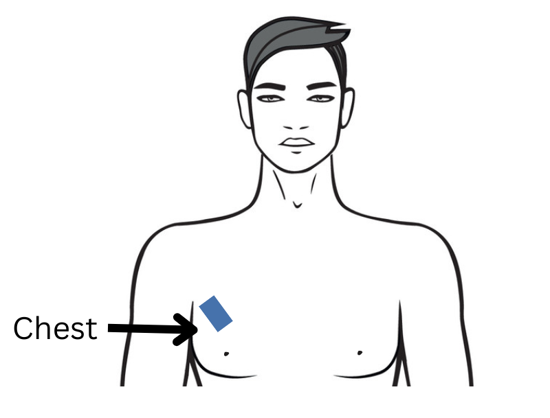 Illustration of the chest skinfold site between the armpit and nipple