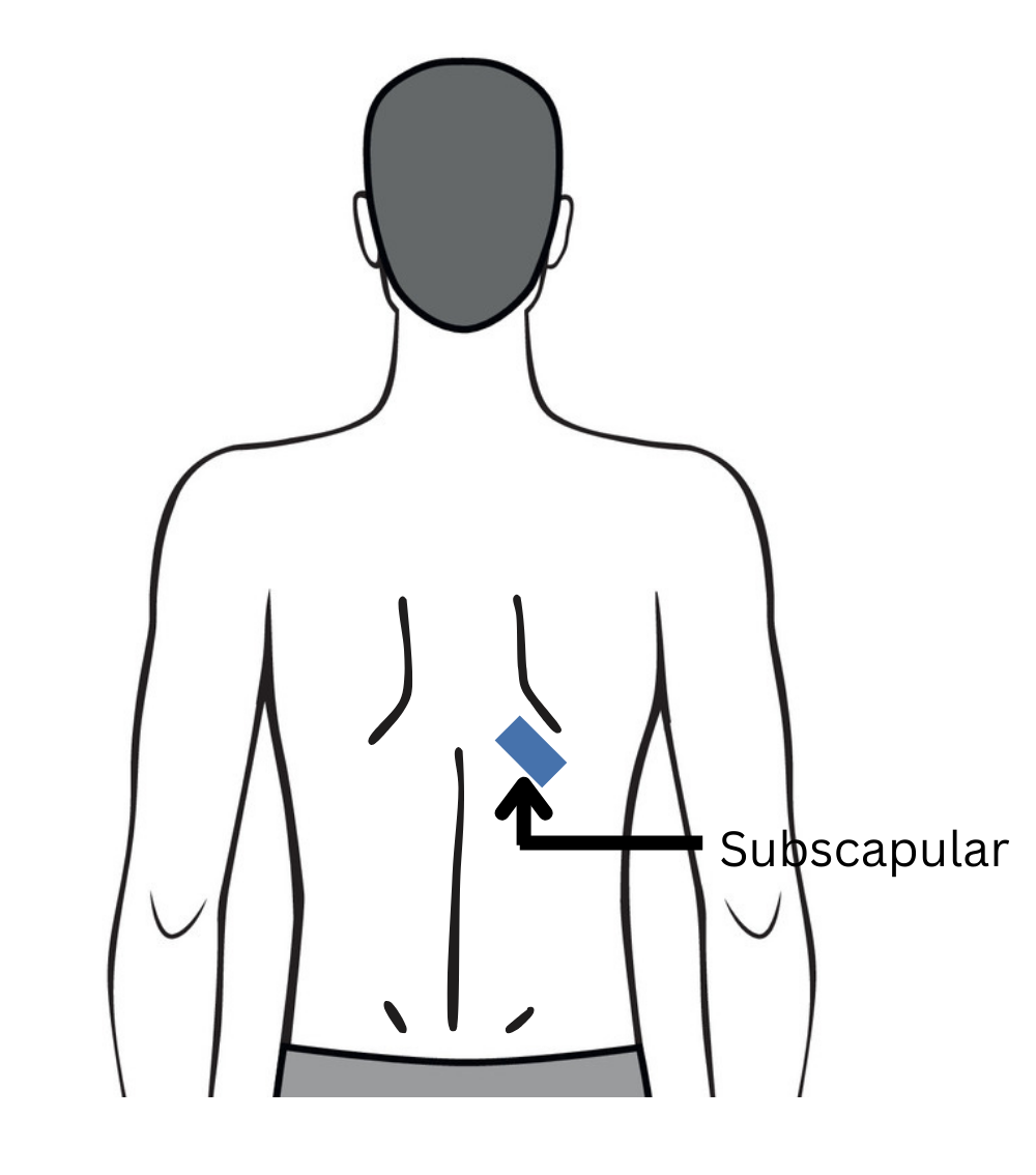 Illustration of the subscapular skinfold site below the shoulder blade